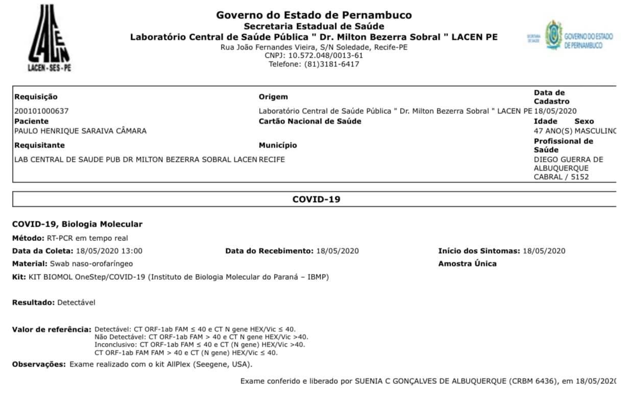 Paulo Câmara apresenta exame que confirma Covid-19